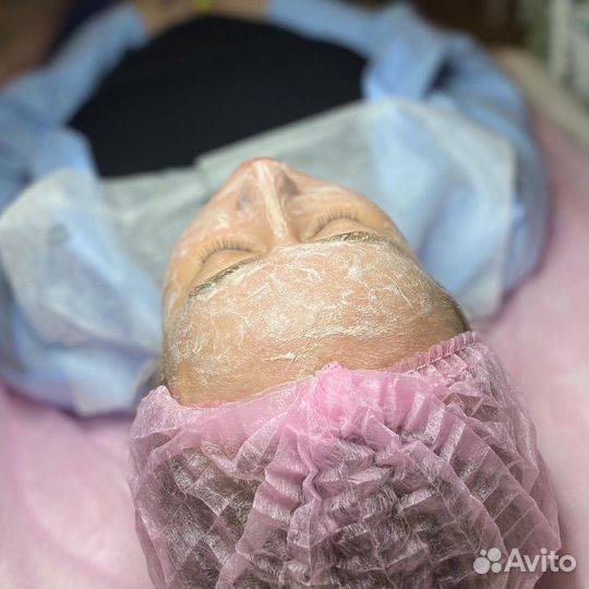 Чистка лица Мезотерапия Биоревитализация