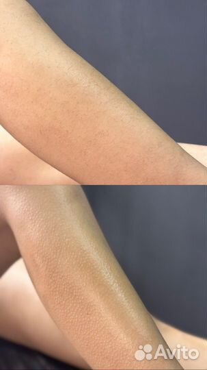 Депиляция воском: глубокое бикини