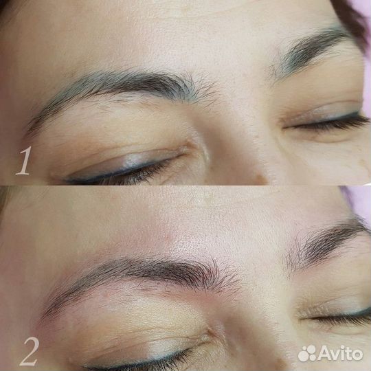 Удаление татуажа перманентного макияжа бровей губ