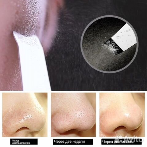 Ультразвуковой очиститель для лица