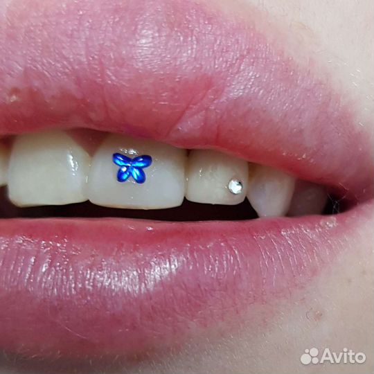 Установка скайсов,твинклов