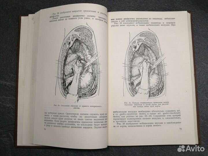 Хирургия вегетативной нервной системы 1947г