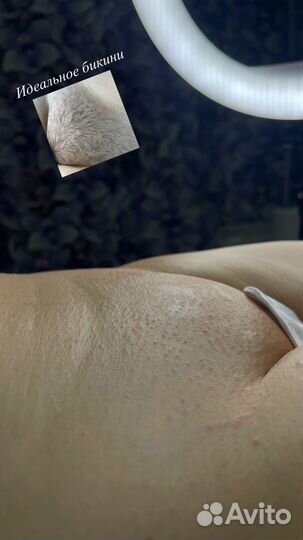 Шугаринг/ваксинг