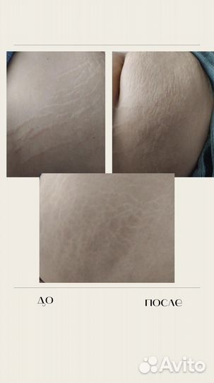 Массаж Лечебный Видное