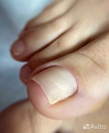 Маникюр. Педикюр