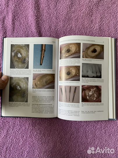 Повторное эндодонтическое лечение, Джон С. Роудз