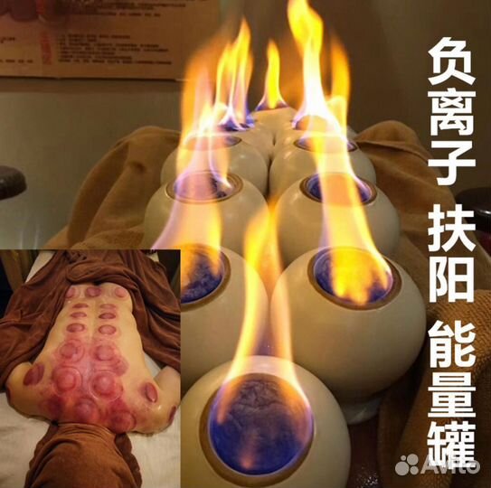 Вакуумные банки для массажа и прогревания