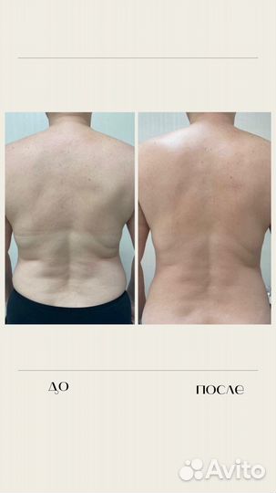 Массаж Лечебный Видное