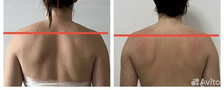 Массаж лица, моделирование тела