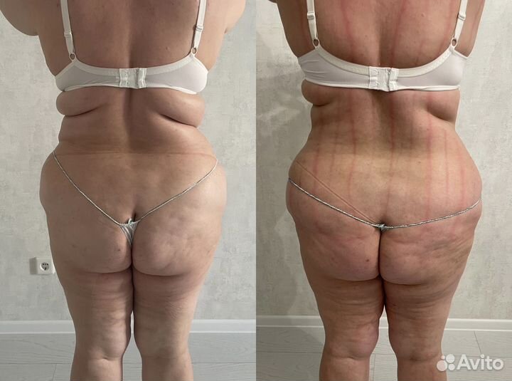 Массаж всего тела