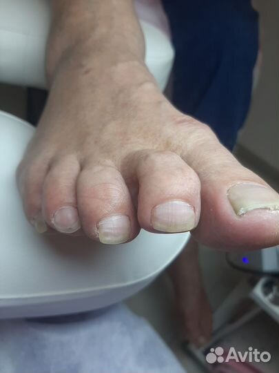 Мужской, женский педикюр