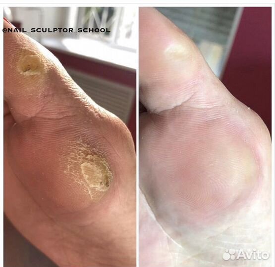 Smart педикюр ламинирование ресниц. звоните