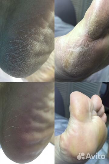 Педикюр smart/kart и Ламинирование Ресниц Inlei