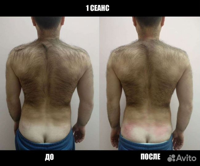 Костоправ Иваново