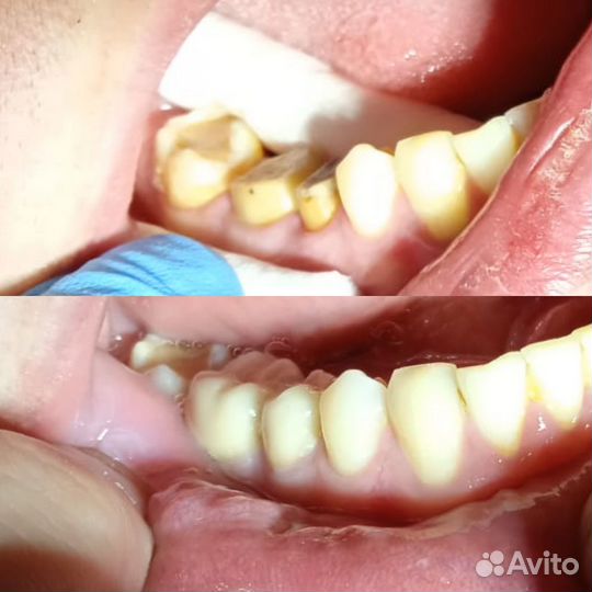 Зубной техник керамист