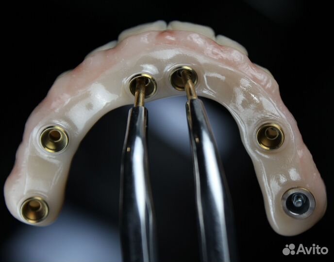 Зуботехническая лаборатория Моделирование Exocad