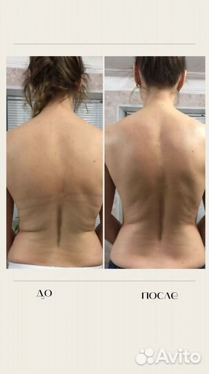 Массаж Лечебный Видное