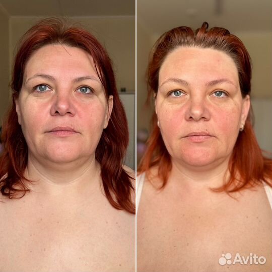 Массаж лица и тела