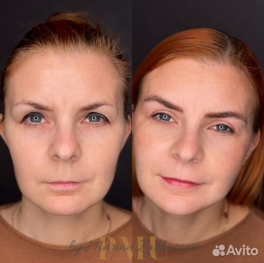 Волосковая техника, удаление пм,татуаж,перекрытие