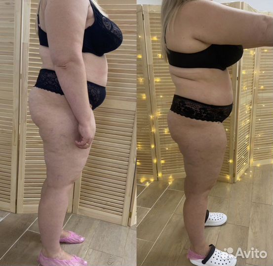 Lpg массаж тела и лица,жиротоп Microwave