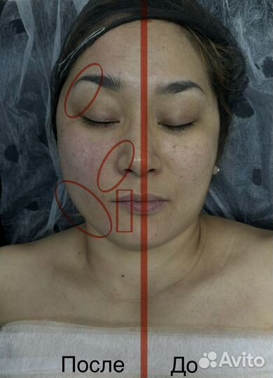 Массаж лица обучение Казань