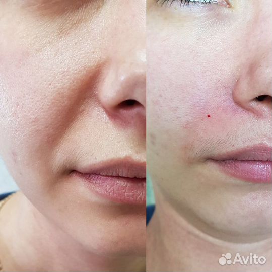 Услуги косметолога