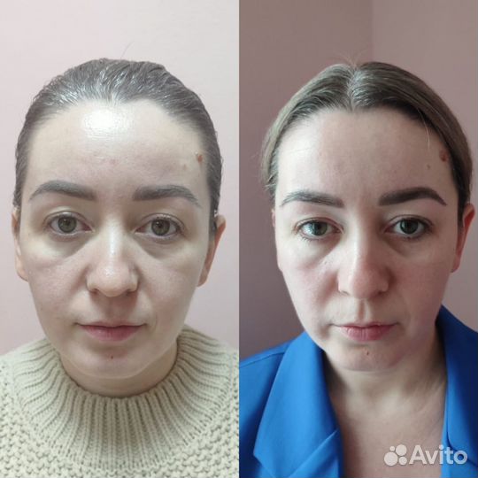 Массаж лица по техники эффект фотошопа