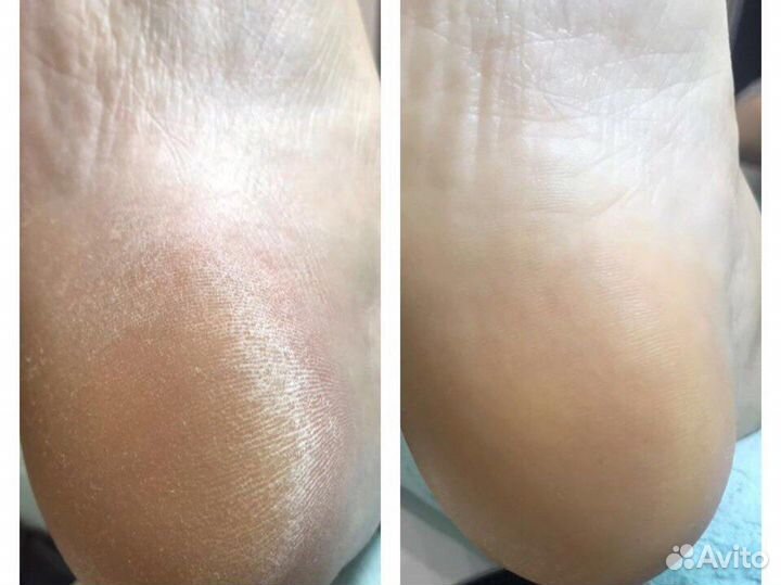 Педикюр маникюр