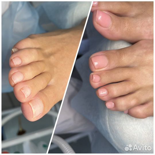 Педикюр + подолог