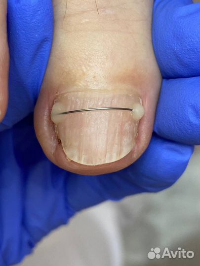 Модель на педикюр