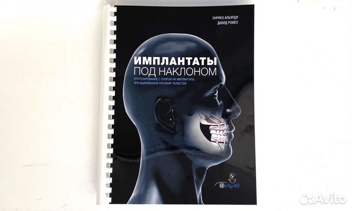 Имплантаты под наклоном