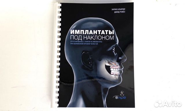 Имплантаты под наклоном