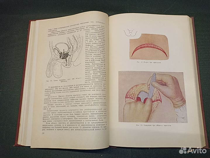 Гнойная хирургия. Стручков. 1962
