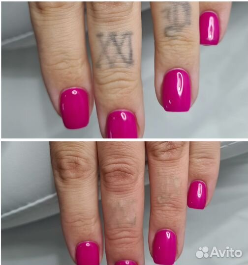 Удаление татуажа. Удаляем стрелки