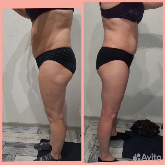 Похудеть быстро. Массаж. Коррекция фигуры и лица