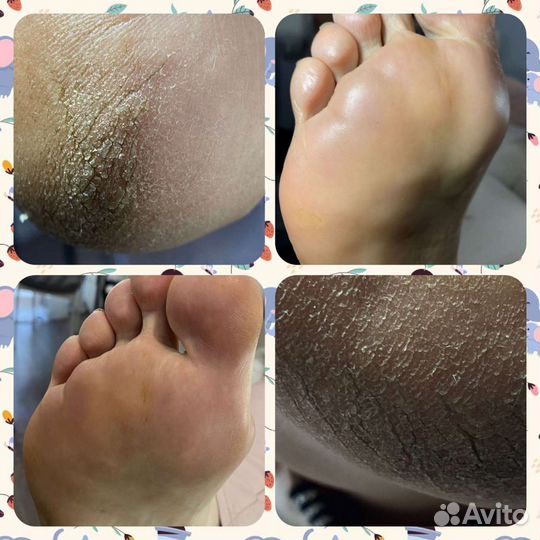 Маникюр, педикюр