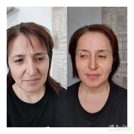 Услуги врача-косметолога