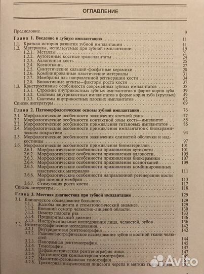 Имплантация зубов