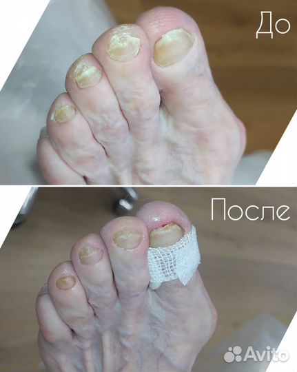 Подолог екатеринбург