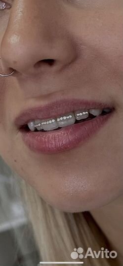 Скайсы / твинклы/ страз на зуб / tooth gems