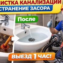 Прочистка канализации, устранение засора Туголесский Бор, Рошаль