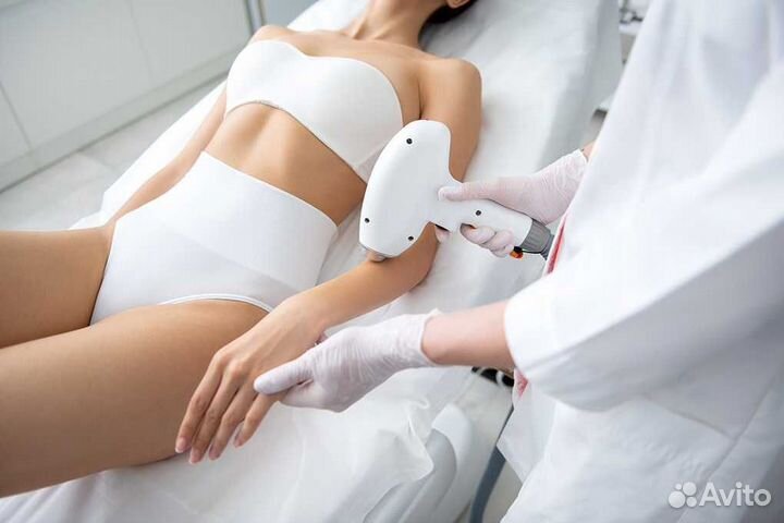 Лазерная эпиляция