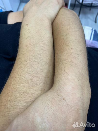 Нужны модели/Восковая депиляция