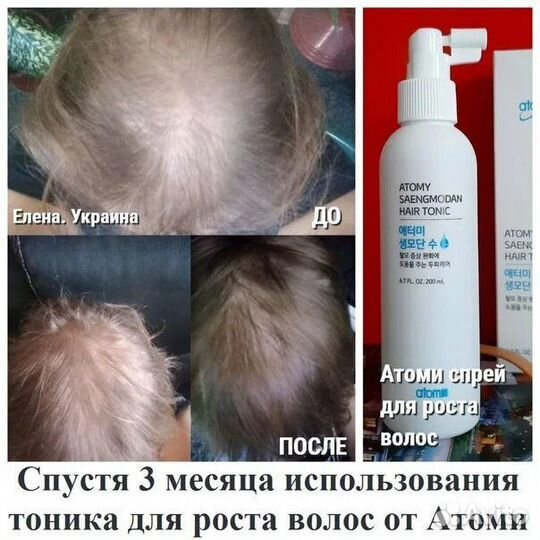 Спрей от выпадения волос Атоми Корея