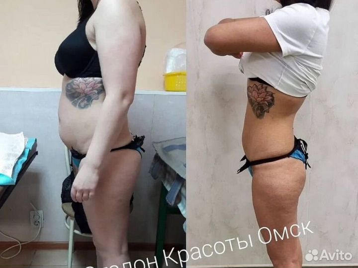 Требуются модели /массаж/кавитация