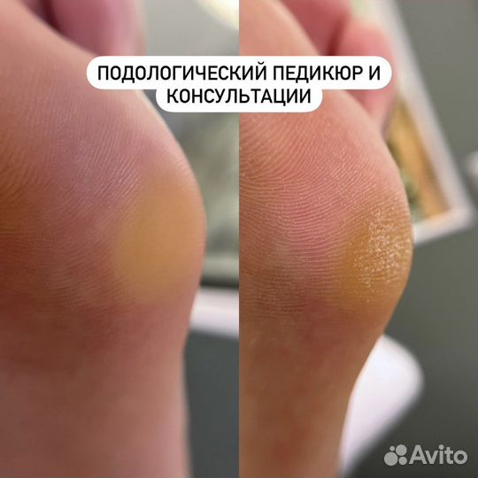 Подолог / Подология