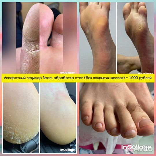 Мастер маникюра и педикюра