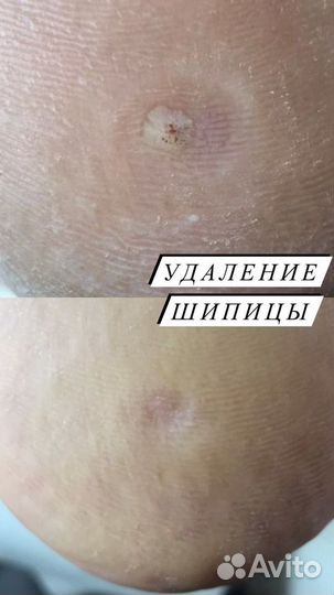 Маникюр, педикюр, подология