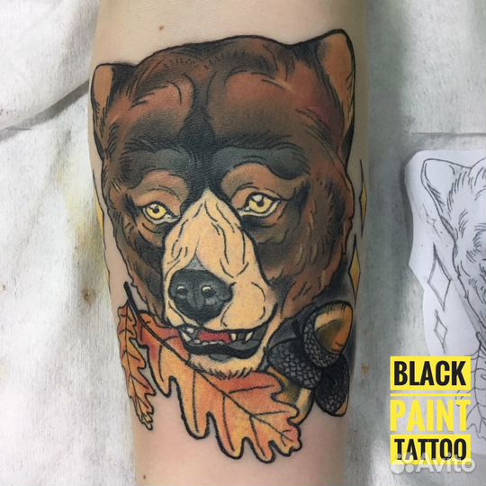 Удаление татуировок