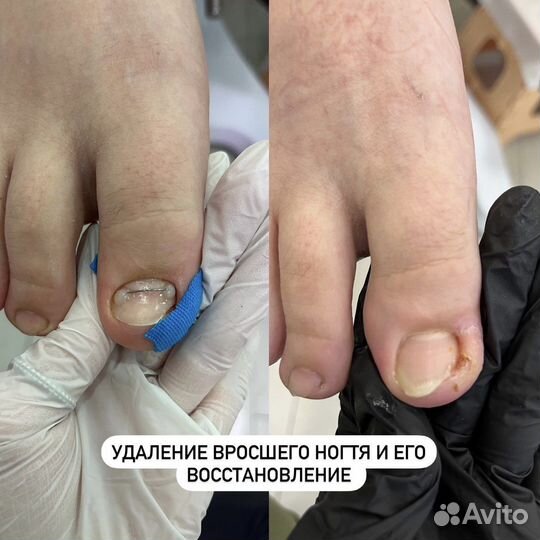 Подолог / Подология